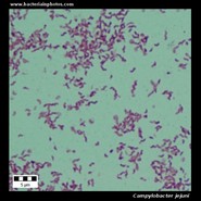 campylobacter jejuni under microscope